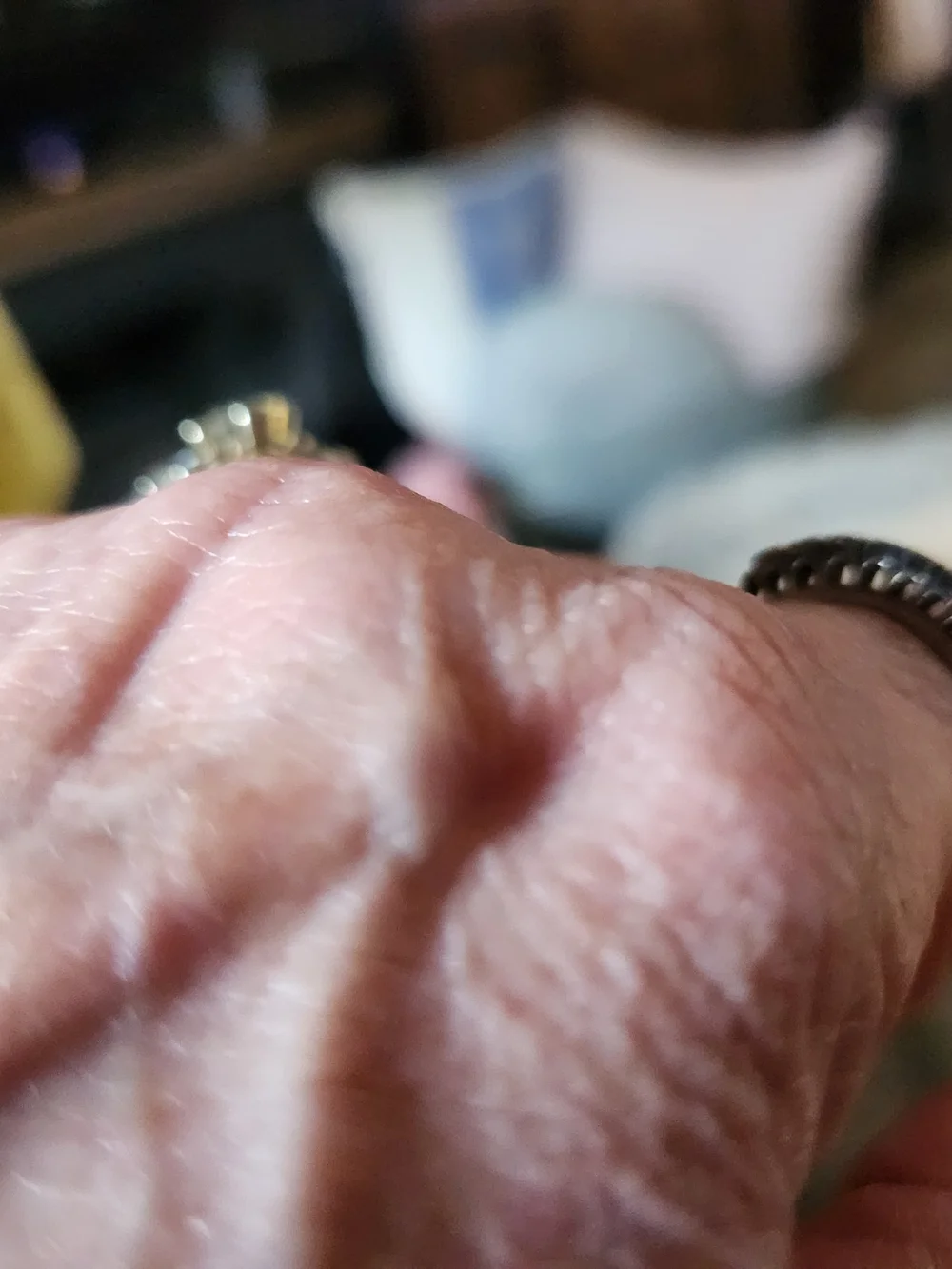 DIAMOND RING - Picture 5 of 11